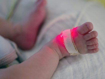 France launches nationwide probe into baby arm deformations
