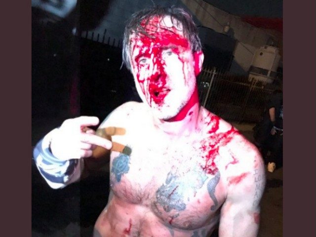 David Arquette Competes In Brutal Deathmatch Against Nick Gage