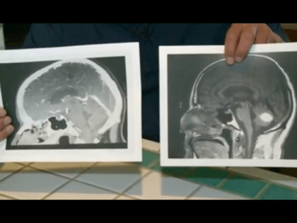 Two Brain Scans
