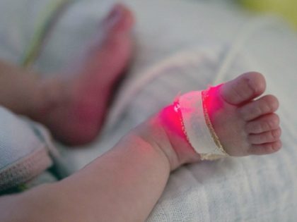 France launches nationwide probe into baby arm birth defects. A relatively small number of cases have been detected so far -- about 25 over the past 15 years in the regions of Brittany, Loire-Atlantique and Ain -- but the defects have caused public alarm and have been widely reported by …