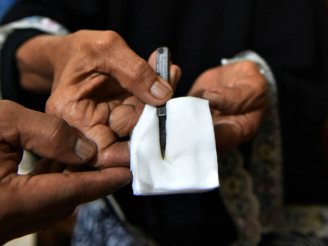 In this photograph taken on February 20, 2017, a traditional healer shows cutting tools used to circumcise women in Gorontalo, in Indonesia's Gorontalo province. Female circumcision -- also known as female genital mutilation or FGM -- has been practised for generations across Indonesia, which is the world's biggest Muslim-majority country, …