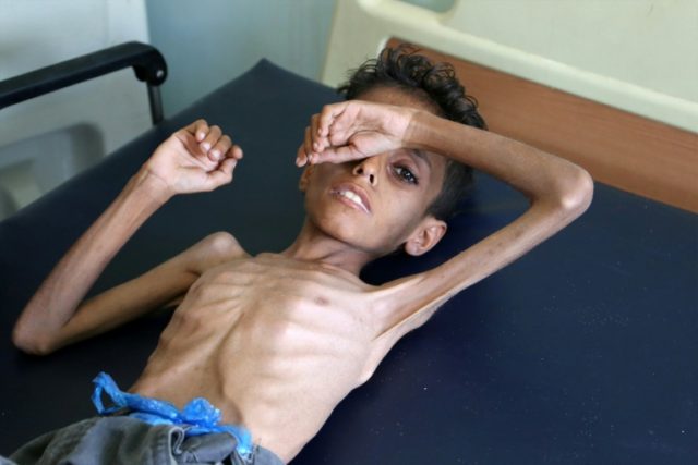 UN chief calls for halt to Yemen violence