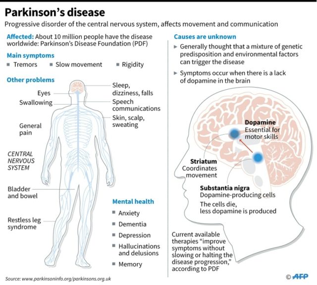 Japan team transplants stem cells into brain to treat Parkinson's