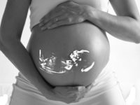 pregnancy-ultrasound-fetus-in-utero-pixabay pregnant woman and ultrasound fetus