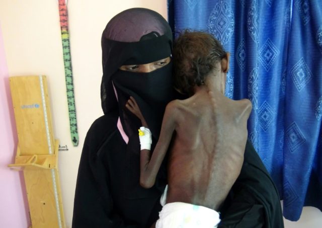 Around 20 million Yemenis food insecure due to ongoing conflict