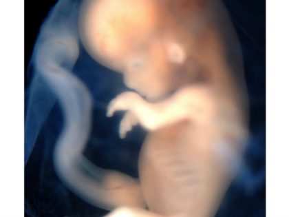 NEW ZEALAND - DECEMBER 01: Stock Photography. A 3D ultrasound showing a baby inside the womb. (Photo by Fotopress/Getty Images)