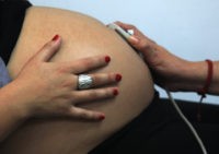 Rayen Luna Solar, 27, 33-week pregnant, is seen by a midwife in a routine checkup, in Santiago, on July 13, 2012. In Chile 38 percent of the births are carried out by caesarean section --with up to 60 percent in private hospitals-- the third highest rate in Latin America, following …