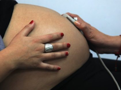Rayen Luna Solar, 27, 33-week pregnant, is seen by a midwife in a routine checkup, in Santiago, on July 13, 2012. In Chile 38 percent of the births are carried out by caesarean section --with up to 60 percent in private hospitals-- the third highest rate in Latin America, following …