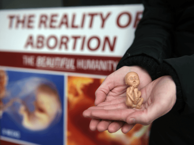 A Pro Life campaigner displays a plastic doll representing a 12 week old foetus as she sta