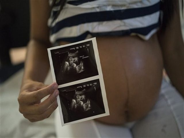 Isabela Cristina, 18, who is six months pregnant, shows a photo of her ultrasound at the IMIP hospital in Recife, Pernambuco state, Brazil, Wednesday, Feb. 3, 2016. Isabela Cristina was struck with Zika and was worried about the health of her bay, but her baby's ultrasound scan and other exams …