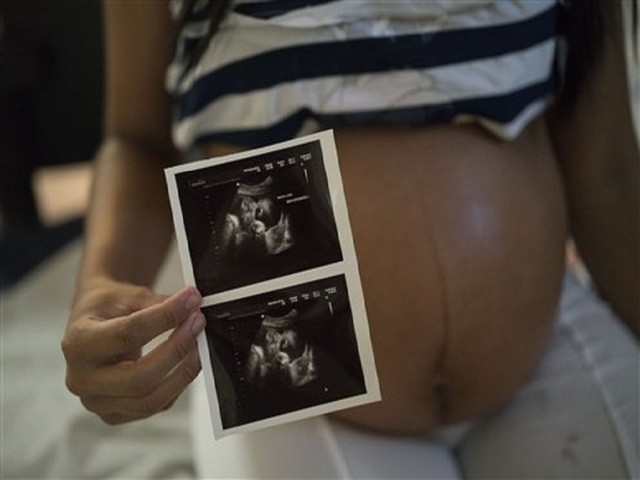 Isabela Cristina, 18, who is six months pregnant, shows a photo of her ultrasound at the IMIP hospital in Recife, Pernambuco state, Brazil, Wednesday, Feb. 3, 2016. Isabela Cristina was struck with Zika and was worried about the health of her bay, but her baby's ultrasound scan and other exams turned up normal. Brazil is in the midst of a Zika virus outbreak, spread by the Aedes aegypti mosquito, which is well-adapted to humans, thrives in people's homes and can breed in even a bottle cap's-worth of stagnant water. The virus is suspected to be linked with occurrences of microcephaly in new born babies. (AP Photo/Felipe Dana)