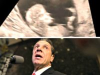 Ultrasound, Cuomo Looking Up jpg Ultrasound, Cuomo Looking Up jpg