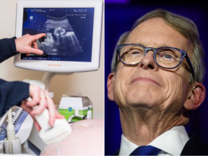 Ultrasound and Ohio Gov. Mike DeWine - collage.