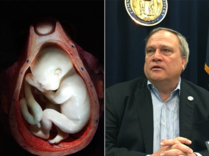 Fetus, Kentucky State Senate President Robert Stivers - collage.
