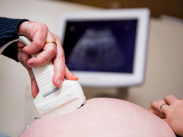 This picture shows a doctor doing an ultrasound examination during a visit of a pregnant woman to her gynecologist, January 31, 2019. (Jasper Jacobs/AFP/Getty Images)
