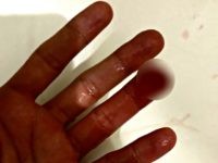 Finger Photo
