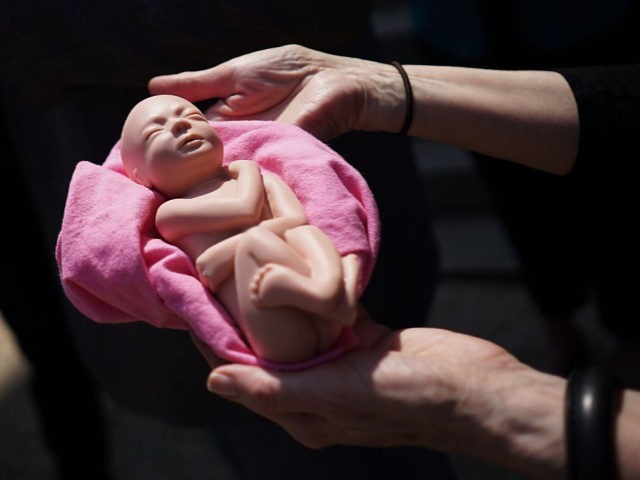 An anti-abortion activist holds a model of a fetus during a protest outside of the Longworth House Office Building on Capitol Hill in Washington, DC on May 7, 2015. Protesters are demanding Republican lawmakers approve a bill banning all abotions after 20 weeks.