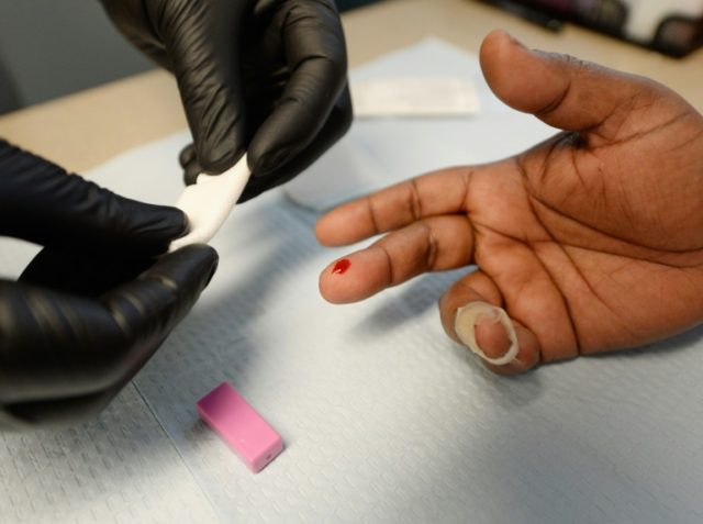 Nearly four in 10 US HIV infections from people unaware of infection