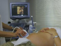 doctor pregnancy ultrasound