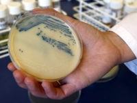 This Oct. 12, 2009 photo shows a petri dish with methicillin-resistant Staphylococcus aureus (MSRA) cultures at the Queen Elizabeth Hospital in King's Lynn, England.
