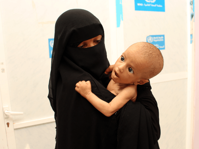 Displaced Yemeni seven-month-old baby Mohammed Hussein suffering from malnutrition is brought by his mother to be checked at a hospital in Yemen's conflict-ridden northwestern Hajjah governorate on June 19, 2019. - The UN's World Food Programme has warned that aid could be suspended to areas of Yemen under the control …