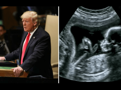 Trump-and-Ultrasound