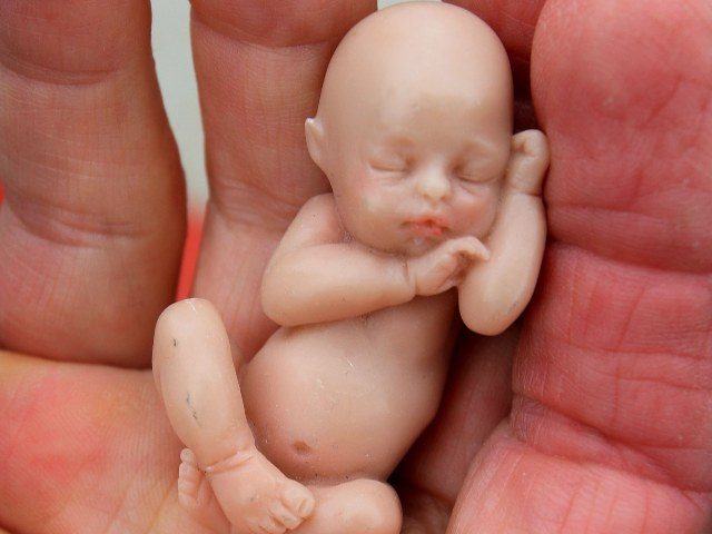 a model of a human fetus