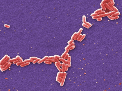 This colorized 2006 scanning electron microscope image made available by the Centers for Disease Control and Prevention shows E. coli bacteria of the O157:H7 strain that produces a powerful toxin which can cause illness.