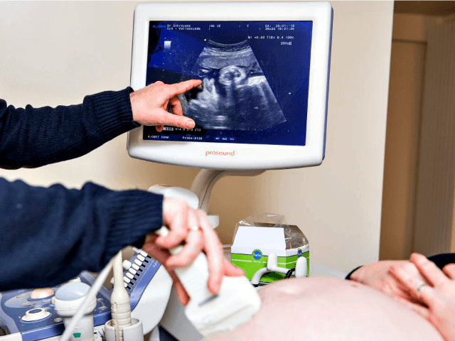 Democrats Tout Unlimited Abortion Bill Disguised as 'Women's Health' Act - Vimarsana News