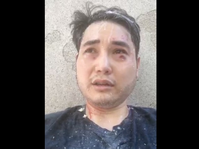 Journalist Andy Ngo was attacked by Antifa protesters in Portland.
