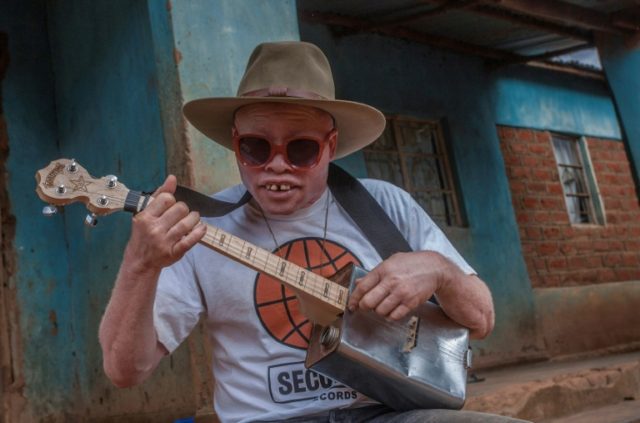 Malawi's albino busker ready for world stage