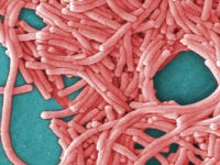This undated image made available by the Centers for Disease Control and Prevention shows a large grouping of Legionella pneumophila bacteria (Legionnaires' disease). (Janice Haney Carr/Centers for Disease Control and Prevention via AP)