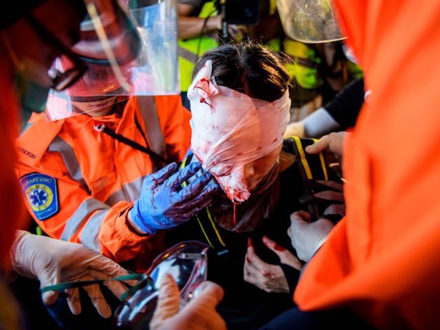 TOPSHOT - EDITORS NOTE: Graphic content / Medics look after a woman who received a facial injury during a standoff between protesters and police in Tsim Sha Tsui in Hong Kong on August 11, 2019, in the latest opposition to a planned extradition law that was quickly evolved into a …