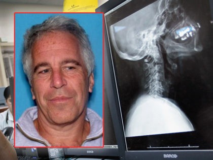 (INSET: Jeffrey Epstein mugshot) MIAMI, FL - APRIL 30: Dr. Daniel Velazquez, M.D. inspects an x-ray of a patient for a possible neck injury at the University of Miami Hospital's Emergency Department on April 30, 2012 in Miami, Florida. As people wait to hear from the United States Supreme Court …