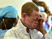 A Senegalese albinos man attends the International Albinism Awareness Day on June 13, 2017, at the cultural centre Douta Seck in Dakar. - Albinism is a hereditary genetic condition which causes a total absence of pigmentation in the skin, hair and eyes. In some countries albinos are kidnapped and their …