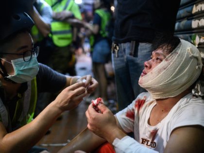 TOPSHOT - An injured man is attended to as he sits on the street after a clash during a pr
