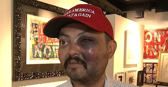 NYC: Man Says He Was Viciously Beaten for Wearing MAGA Hat