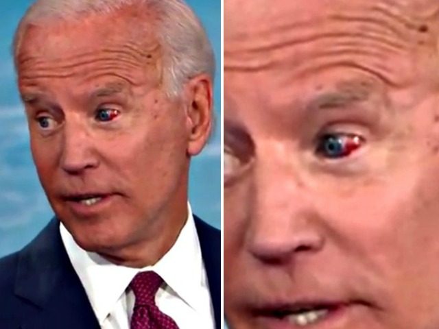 Biden's Eye Fills with Blood While Onstage During Climate Town Hall