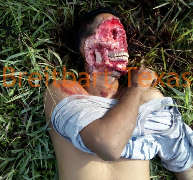 GRAPHIC EXCLUSIVE -- Los Zetas Cartel Cuts Face Off Innocent Victim.