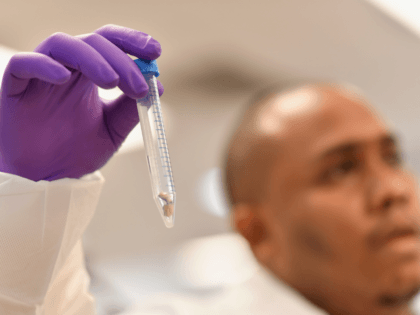 A lab worker holds up bone samples as New York City Office of Chief Medical Examiner hosts DNA Extraction demonstration to unveil groundbreaking technology allowing OCME to test degraded DNA sample on September 6, 2018 in New York. - OCME's Missing Persons Unit handles DNA testing for unidentified persons as …