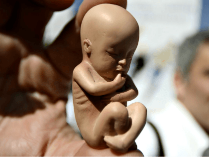 Fetus replica