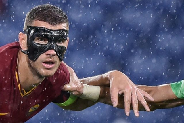 Masked man Dzeko 'can't see very well' but still scores