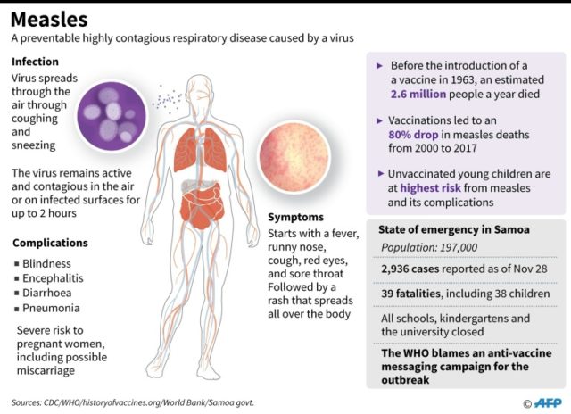 Measles Fears for infants in Samoa as measles deaths mount