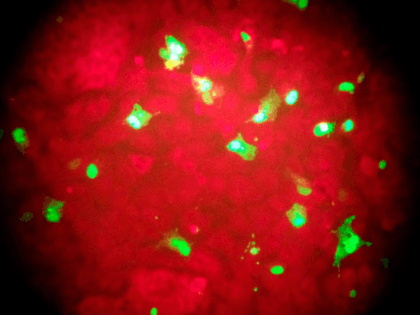 Flu Deaths In this Feb. 26, 2015 photo taken through the eyepiece of a microscope, human cells infected with the flu virus glow green under light from a fluorescence microscope at a laboratory in Seattle. The U.S. government estimates that 80,000 Americans died of flu and flu complications in the …