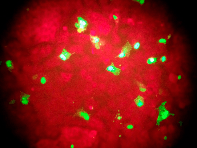 Flu Deaths In this Feb. 26, 2015 photo taken through the eyepiece of a microscope, human c