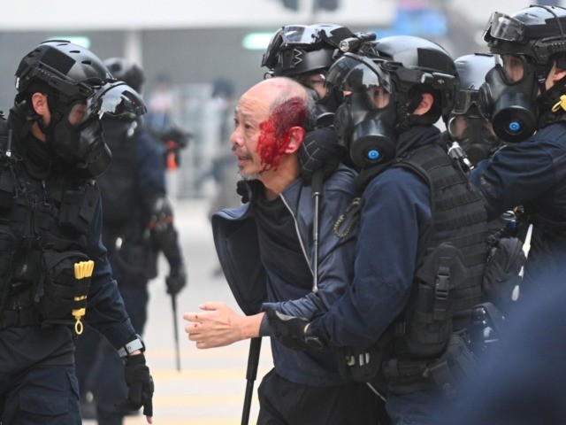 TOPSHOT - Police detain an injured man after police dispersed a crowd gathered for the 'un