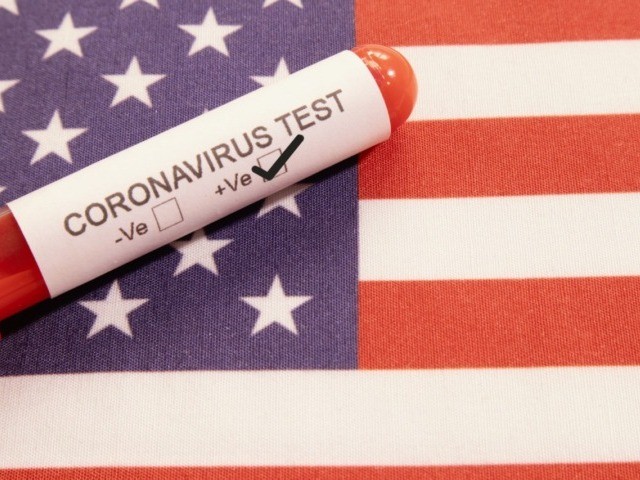 Coronavirus positive test on blood collection tubes on US flag.