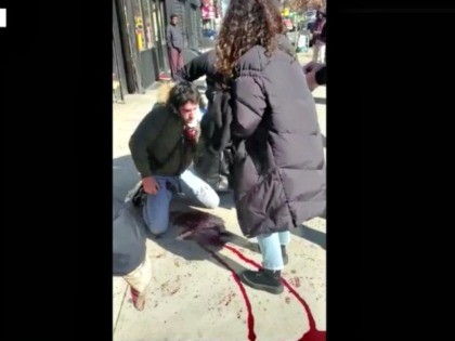 Tourist Slashed in NYC