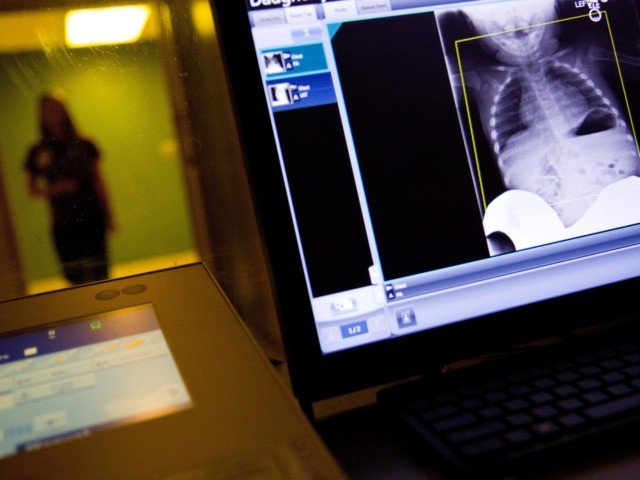 A radiology technician looks at a chest X-ray of a child suffering from flu symptoms at Up