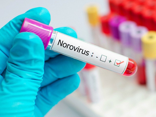 Blood sample positive with Norovirus